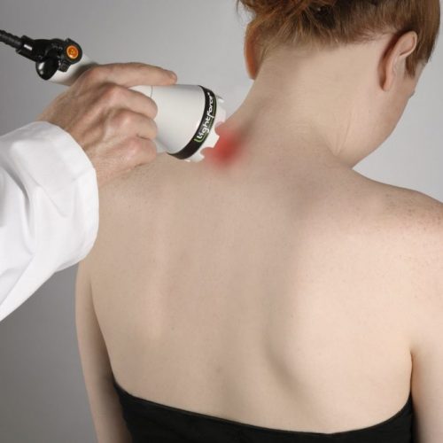 LightForce EX Laser Therapy Neck Treatment